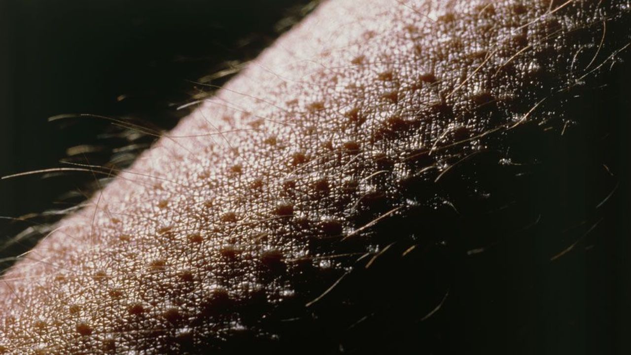 goosebumps